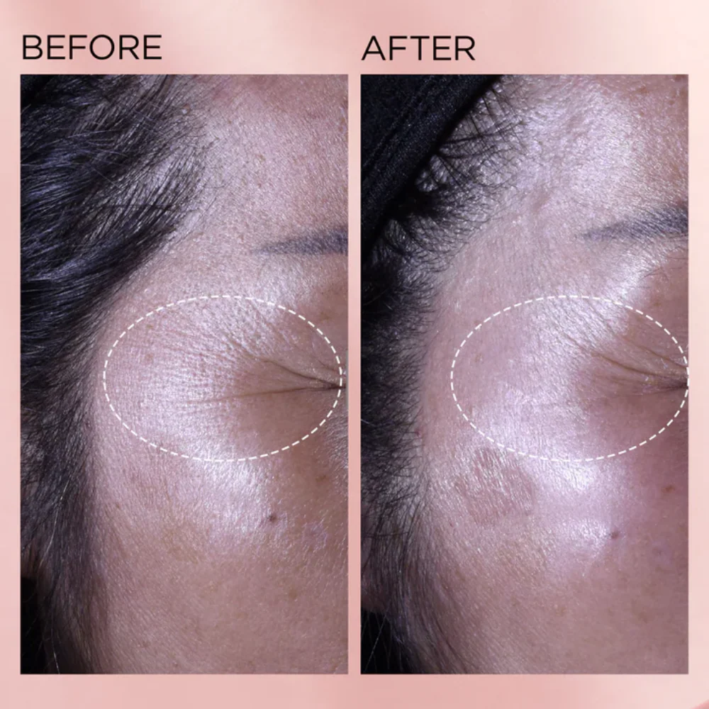 Elizabeth Arden Retinol + HPR Rapid Skin Renewing Ceramide Serum 60 Capsules - Image 5