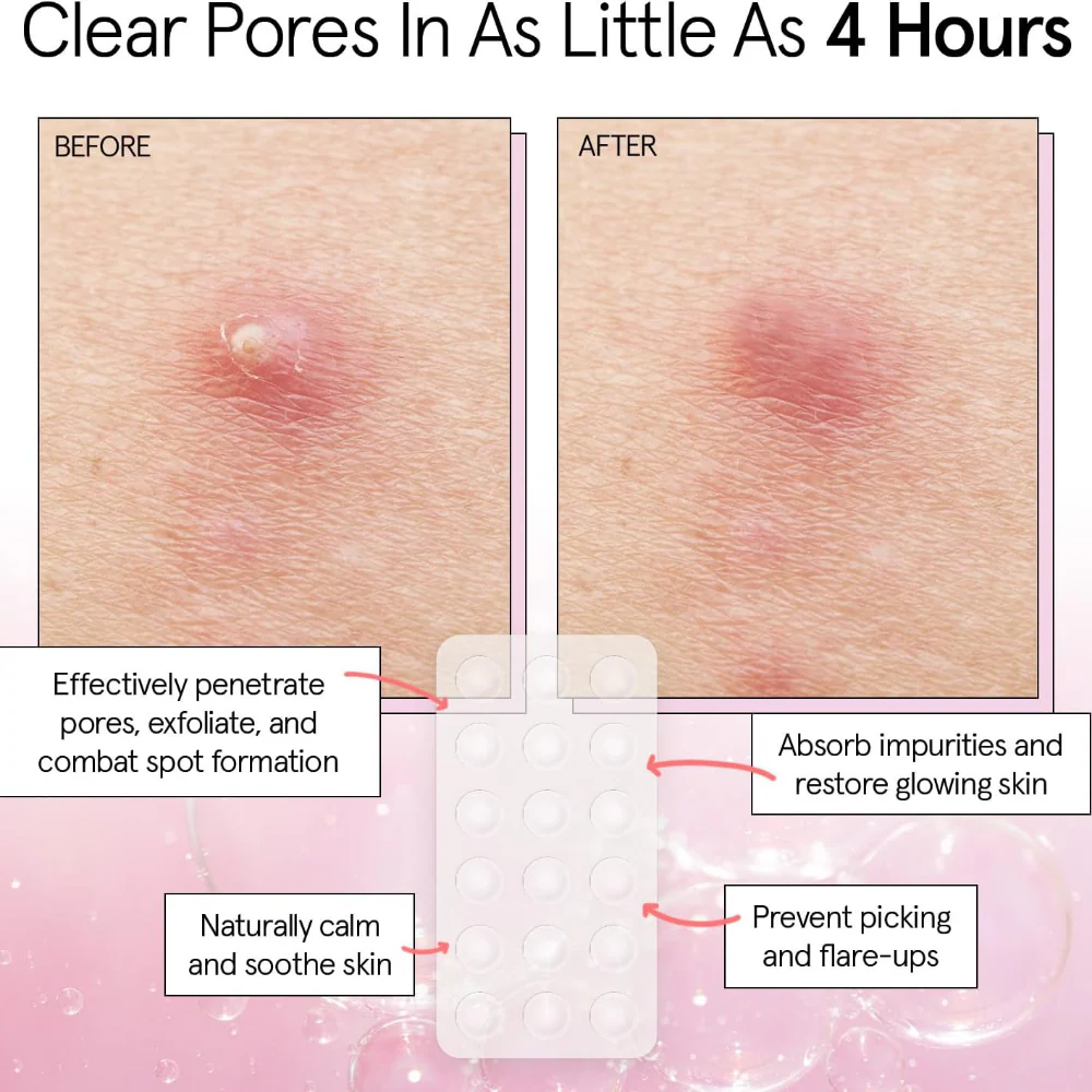 Grace & Stella Hydrocolloid Pimple Patches Clear x36 - Image 3
