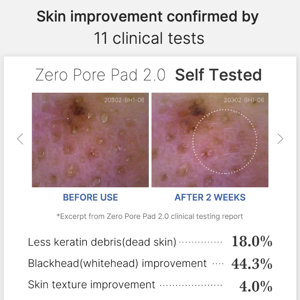 Medicube Zero Pore Pad 2.0 x70 - Image 6