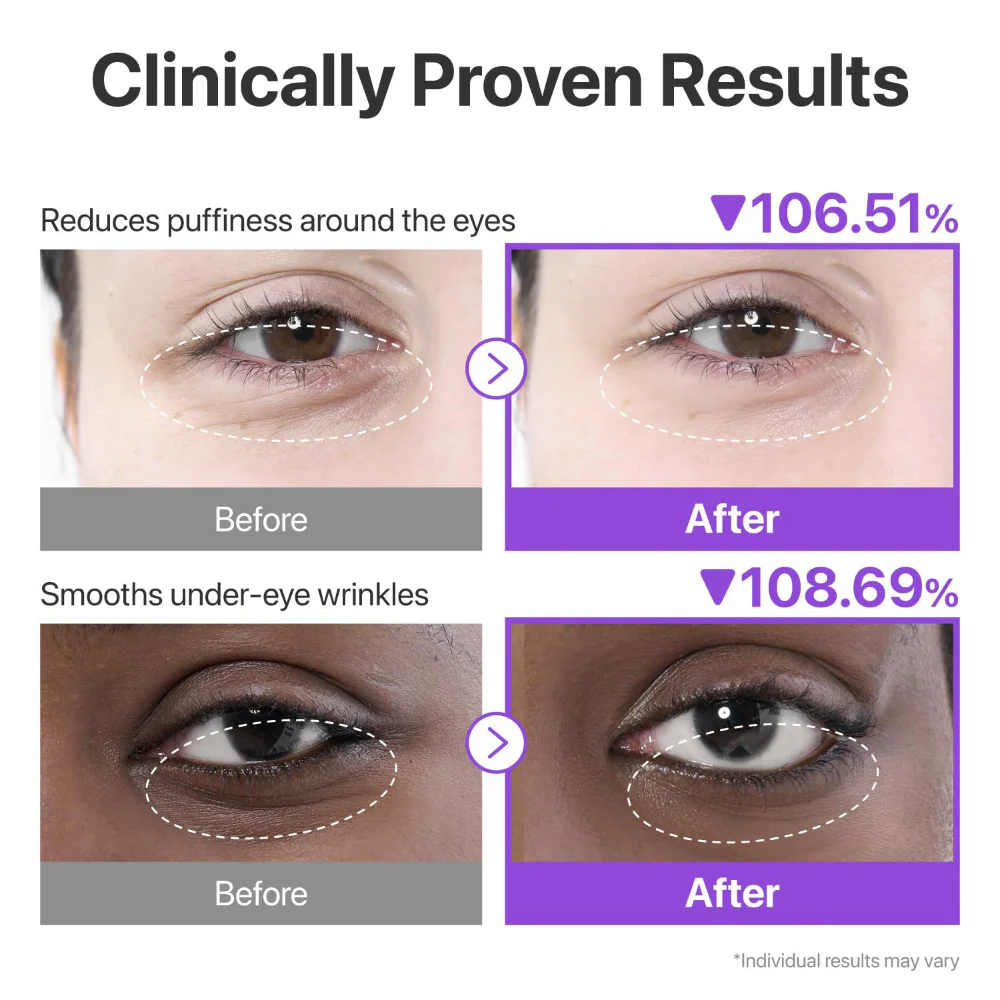 Numbuzin No. 9 NAD+ Collagen Under Eye Patches 5 Pairs - Image 6