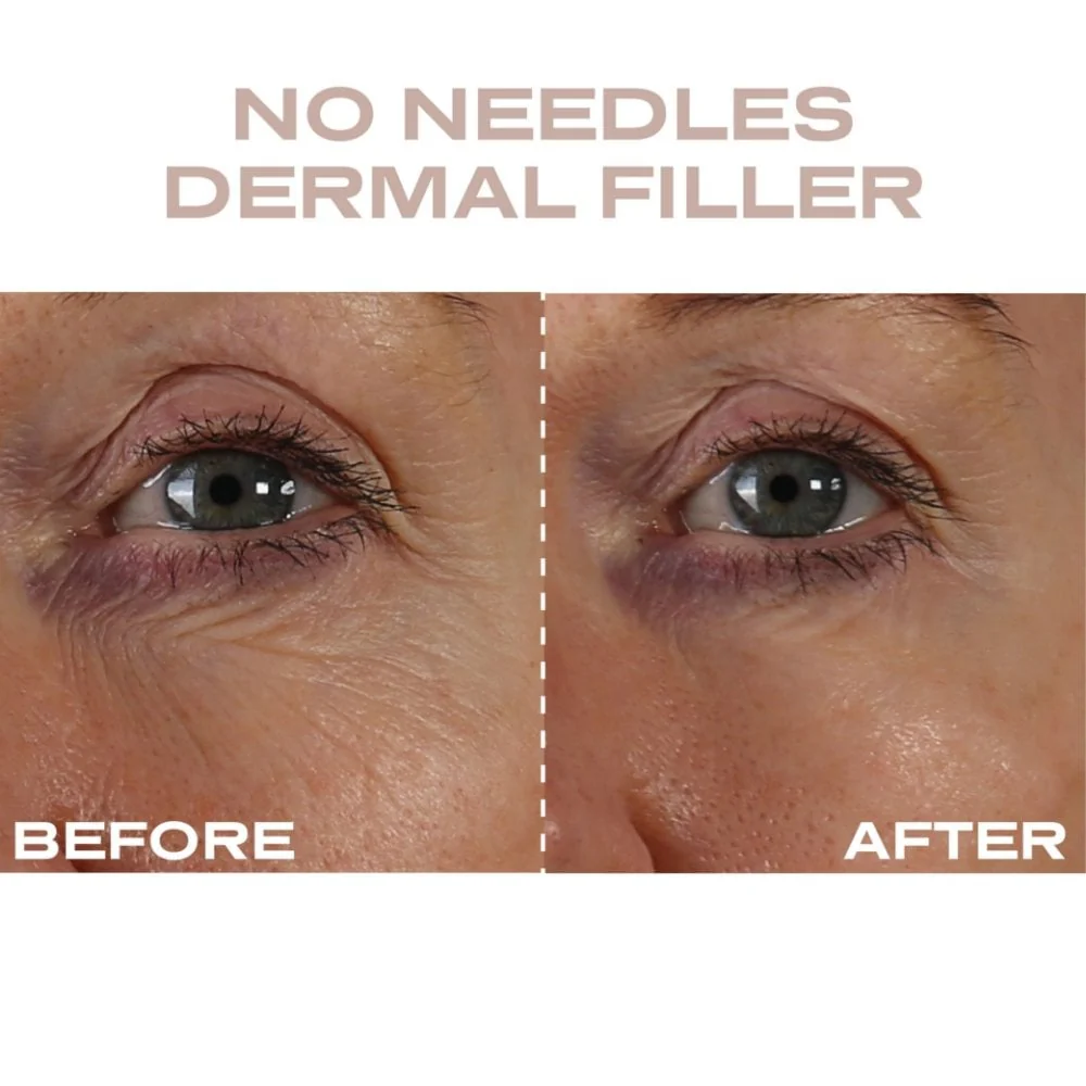 Plump It No Needles Derma Filler Pods Starter Kit 15 x 10ml - Image 2