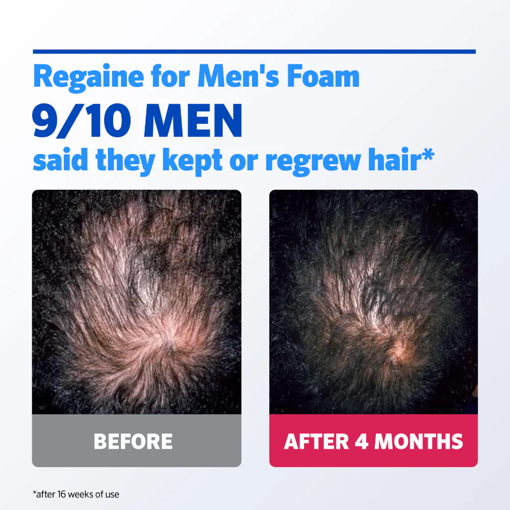 Regaine For Men 5% Extra Strength Regrowth Foam 3 Month Supply - Image 2
