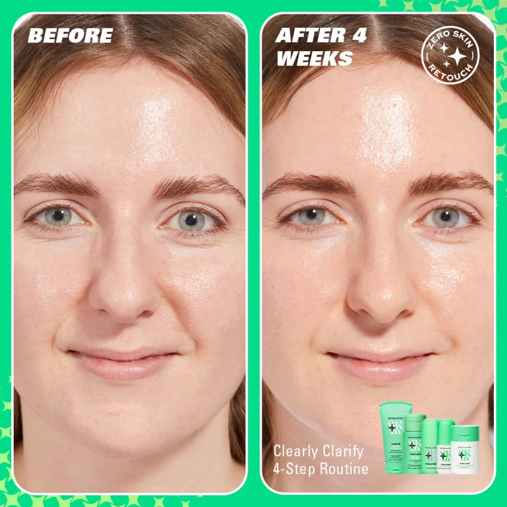 Revolution Skincare Pore Player Clarifying BHA Toner 150ml - Image 4