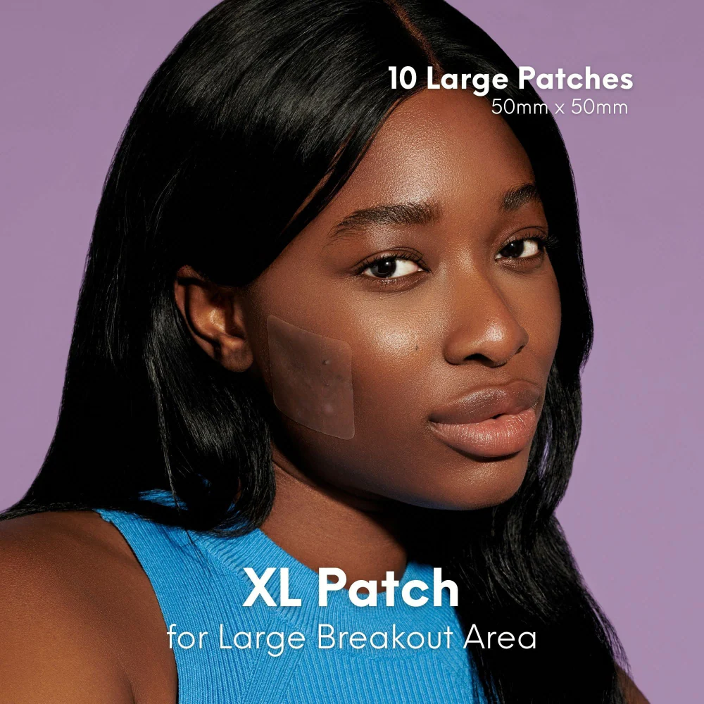 Skin Choice Breakout Patch Classic XL x10 - Image 4