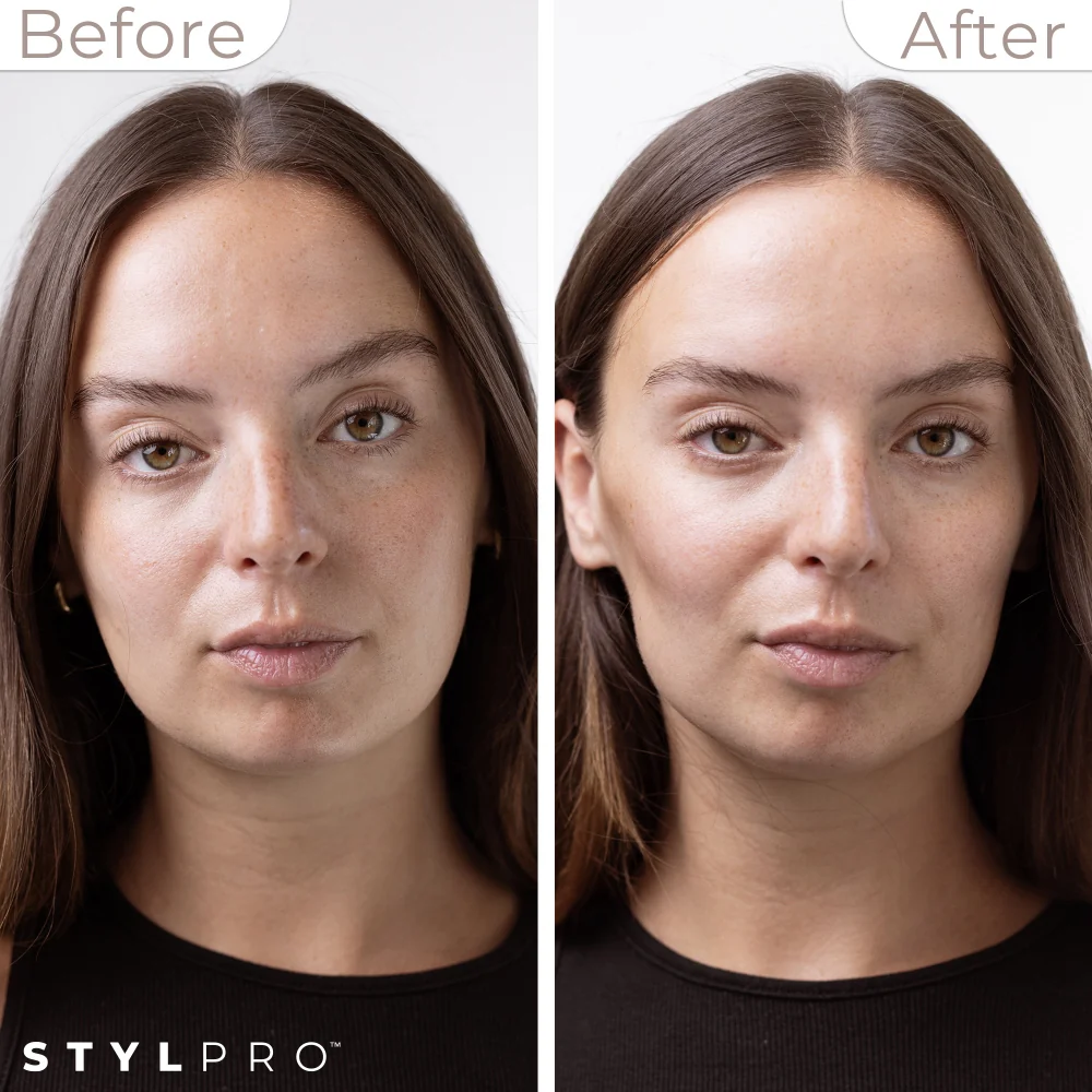 StylPro Mini Microcurrent Facial Toning Device - Image 7